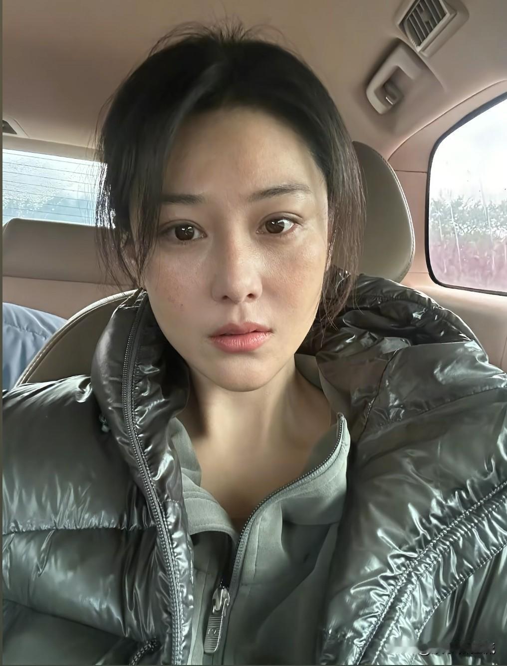 张馨予素颜是怎样的？最近她通过社交媒体账号曝光了一张自己比较特别的形象，皮肤晒伤