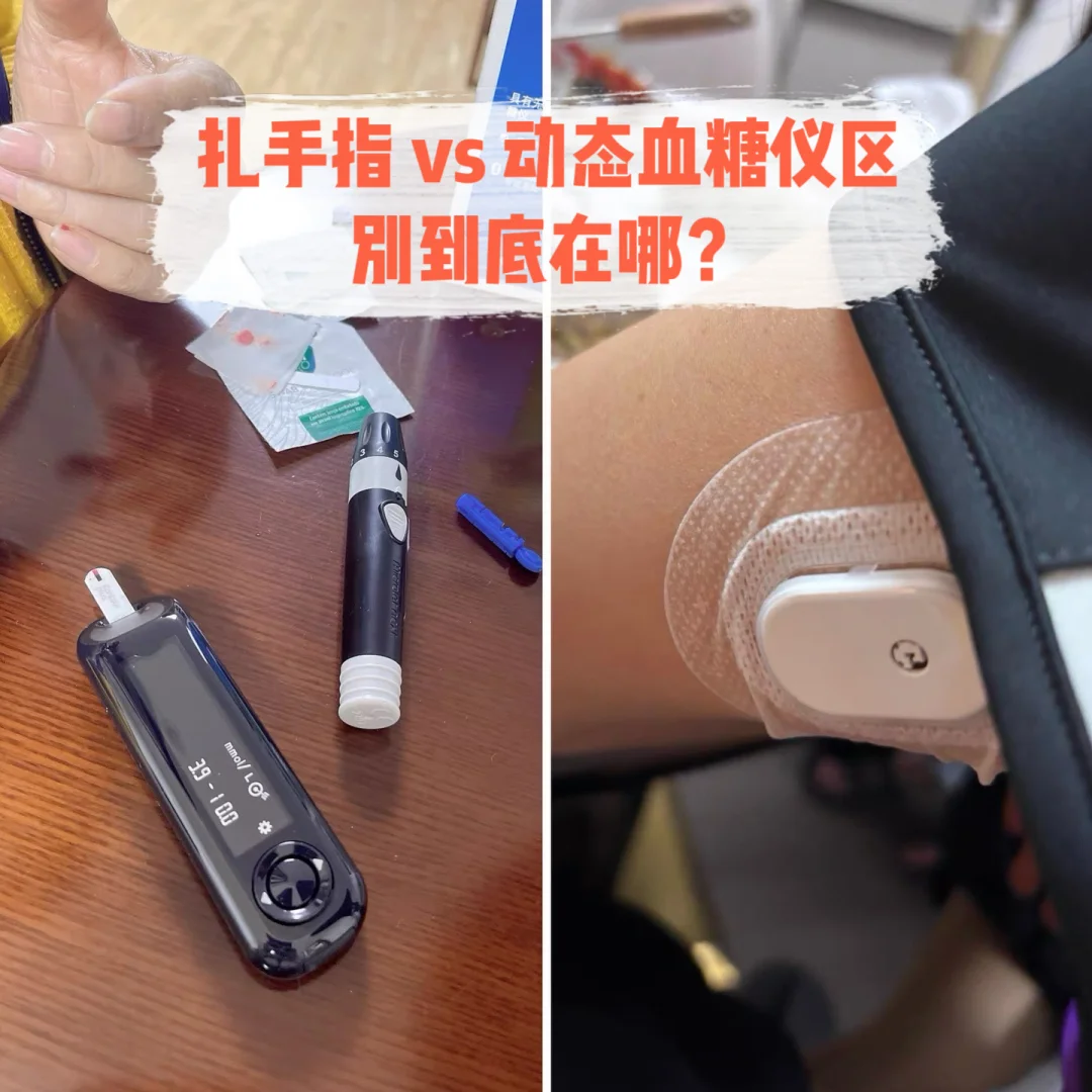 扎手指vs动态血糖仪，区别到底在哪？