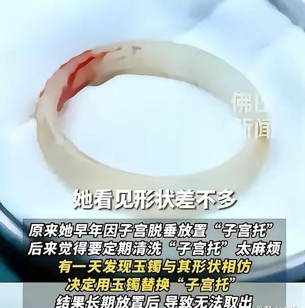 “聪明反被聪明误！”广东，一65岁阿姨因为“下体异物”去医院检查，结果医生发现