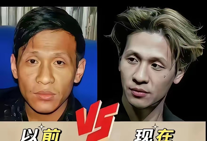 宋小宝动了600刀，割掉的不是眼袋，可能是他的饭碗。他最大的本钱，从来不是包袱，