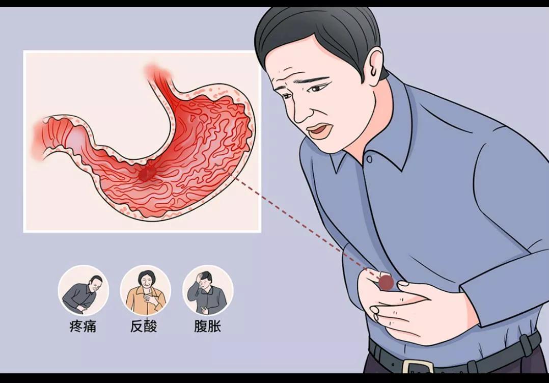 我疼痛腹胀的胃炎终于治愈了，我胃炎有十年了，以前看西医，吃了不少西药，疼痛腹胀只
