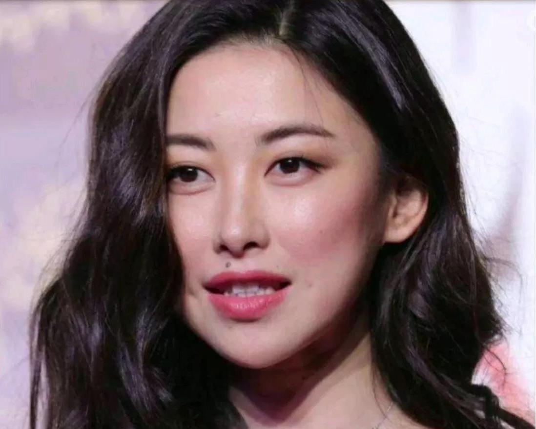 朱珠去痣前后对比照人的脸上有时看似不起眼的小东西。去掉前后相差真的很大。朱