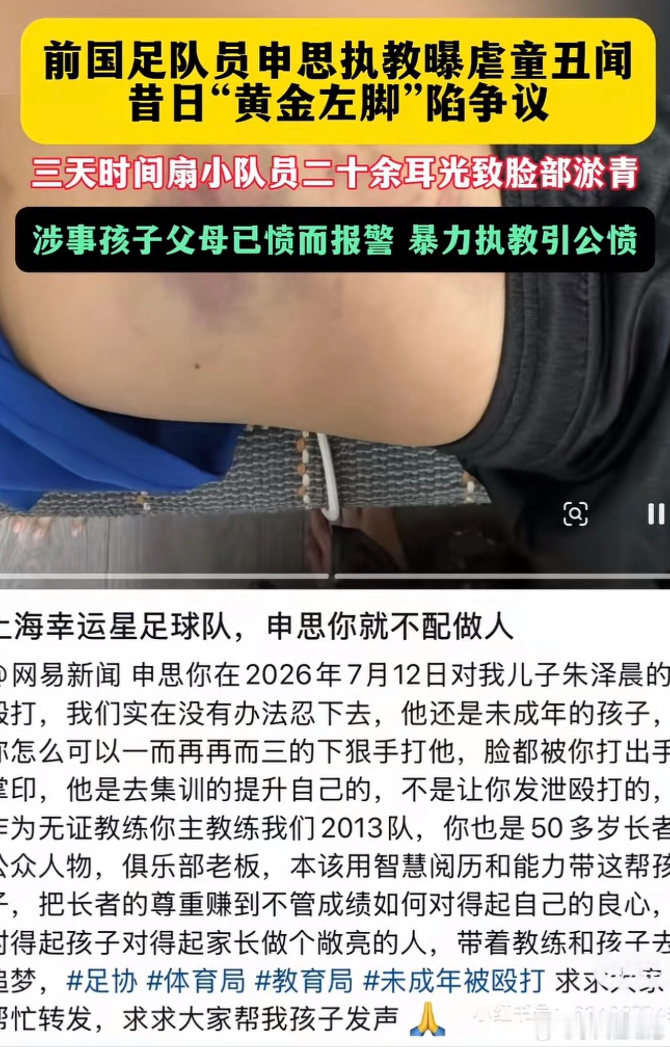 踢球不行，人品也不行？