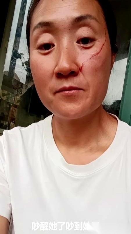 一个刚高考完的女儿，把她妈的脸给打破了。起因，是中午做饭的声音，吵到了她睡觉。