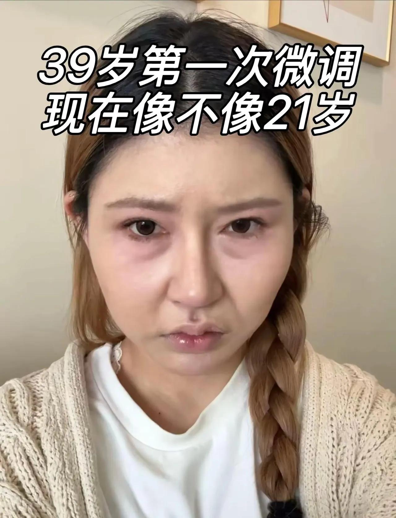 这或许就是很多人想整容的原因吧？简直就是换脸，回家爸妈根本不认识，身份证都得重