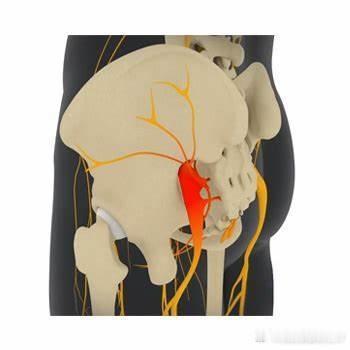 屁股疼的5种原因屁股疼也有不同的疼法：刺痛、灼烧感、伴随麻木，还有的是钝痛、抽