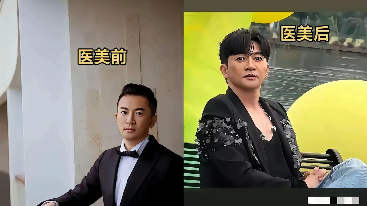 右图是现在的苏有朋？天，完全不敢认。听说好像是做了医美，还不太成功？真的找不