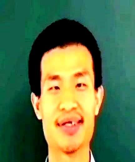 北大医学部彻底懵圈了！他们是做梦也没想到，韦东奕缺牙这事最终的责任居然需要他们