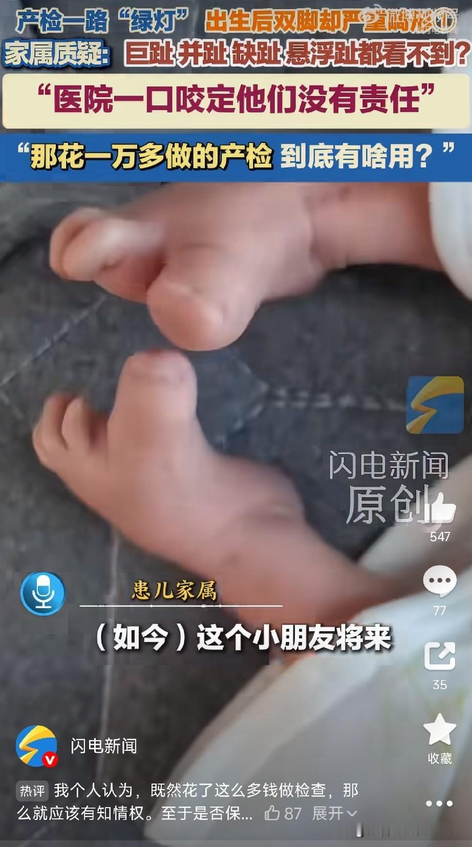 产检到底查不查四肢珠海张女士怀孕后，一直在某某妇幼保健院做产检。前前后后8次