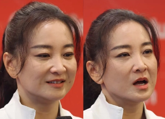 瘦了的贾玲面相变精明了！8月2日，43岁的贾玲现身某运动品牌活动，明显状态比去年