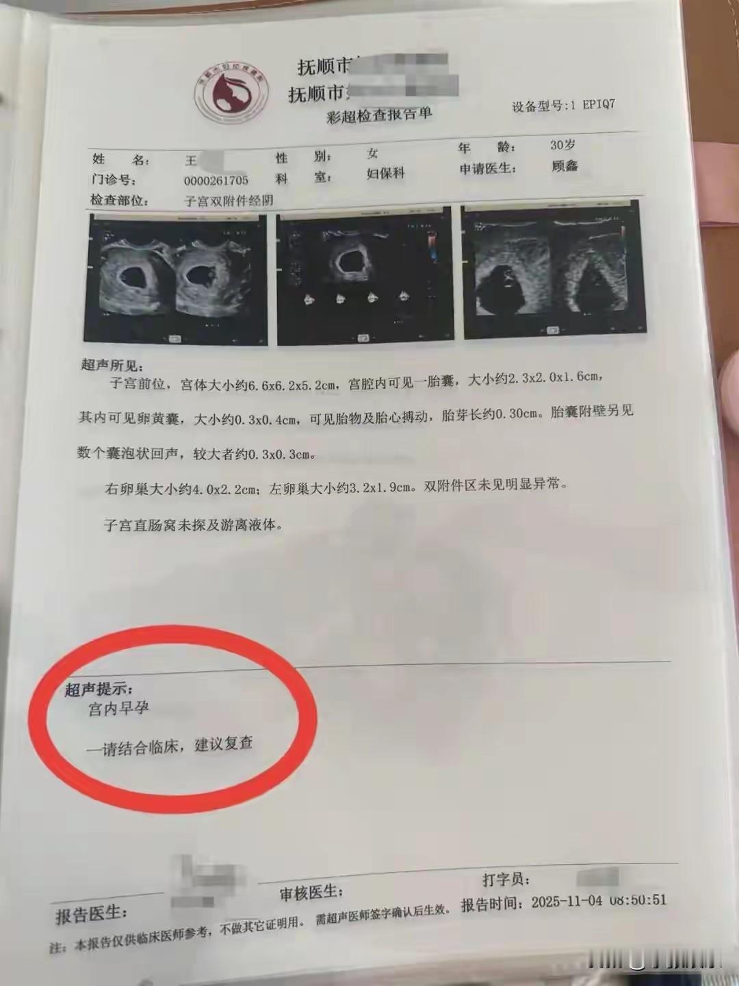 辽宁孕妈产检开盲盒，俩月从1胎变4胎！谁能想到！辽宁一位孕妈产检跟拆盲盒似