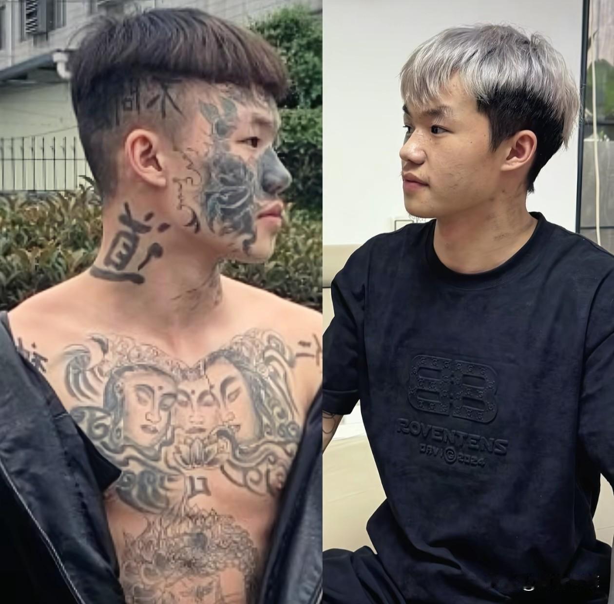 纹面男孩夏朝勇从9岁开始纹身，13岁在脸上纹身，曾把纹身当“护身符”，如今已经洗