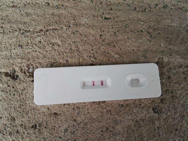 年轻产妇怀孕中期肚子突然变大, 产科医生说从未见过, 医生检查后却笑了