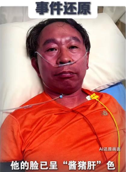 北京，协会医院的一位教授感冒后，也不知怎么想的，吃了一片头孢，万万没想到，他突然
