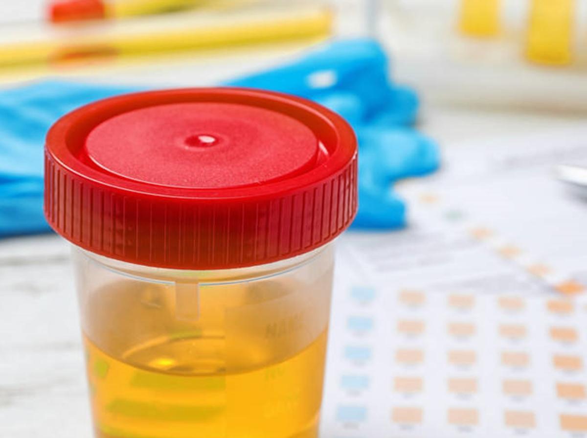 26岁小伙尿酸飙升910，双肾报废，医生怒斥：一种饮料是祸根年纪轻轻，谁会想