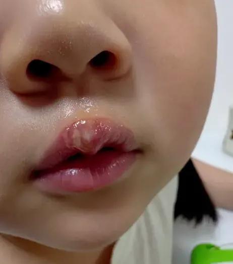 孩子身上的伤，真的只是“不小心磕碰”吗？看完徐州丰县那幼儿园的监控，真的上头