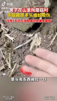 [点赞]“悲剧还是发生了！”8月15日四川自贡，一男子在山里掏蘑菇时，手刚伸进