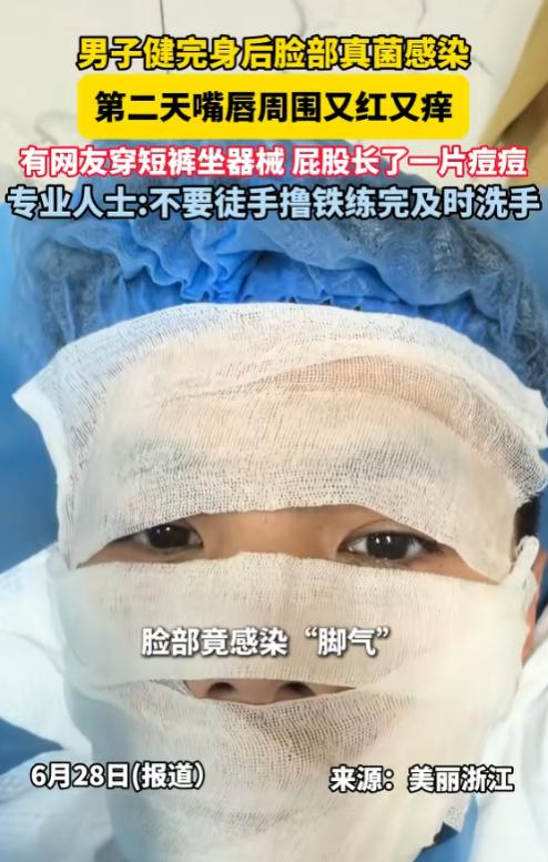 万万没想到！6月28日报道，广东，男子冯先生自己就去健身房练了会儿，结果第二天嘴