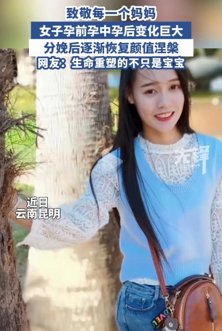 太夸张了！”云南昆明，一女子怀孕前长得很好看，怀孕后却像变了个人似的变得很难看