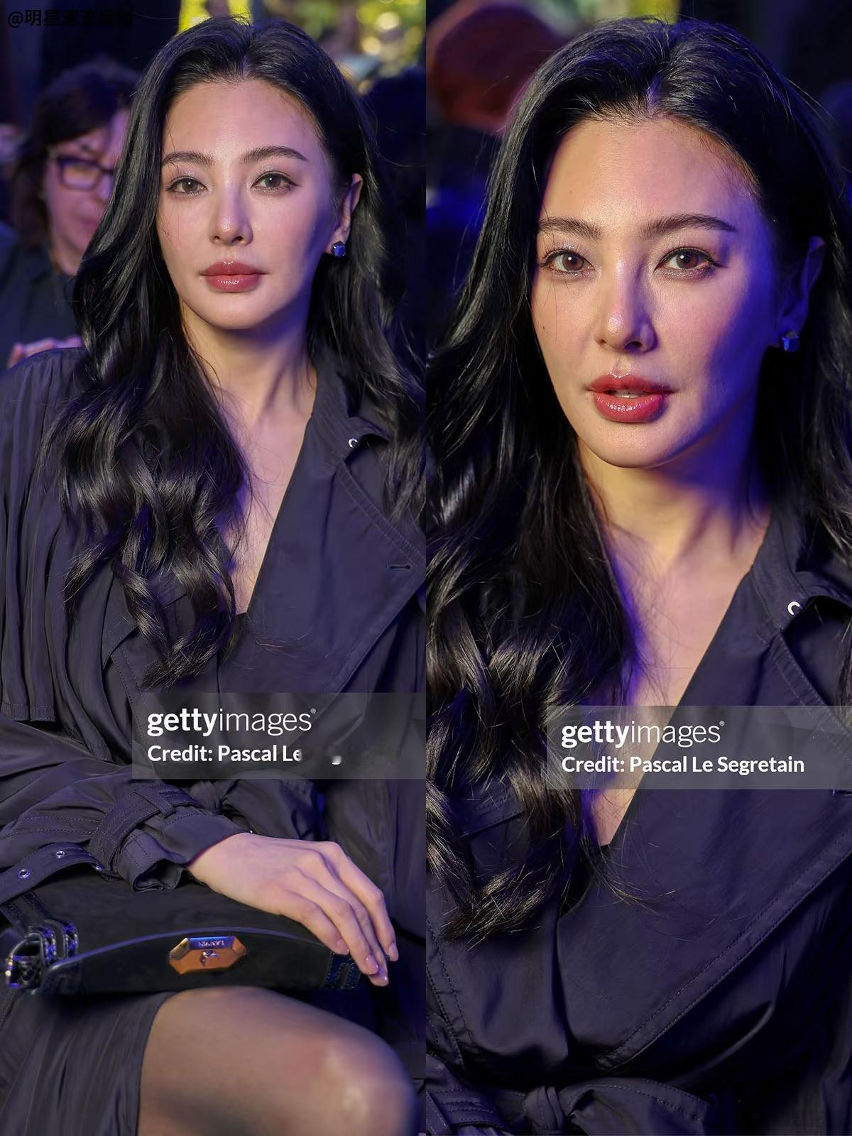 张雨绮的嘴是不是做了丰唇手术？她以前的唇形没有这么厚、这么立体，而且人年纪越大嘴