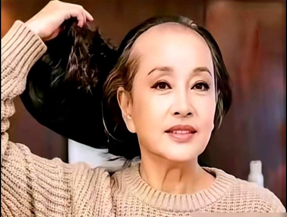 75岁的刘晓庆对着镜头一把扯下戴了三十年的假发，满头银丝瞬间暴露在聚光灯下。