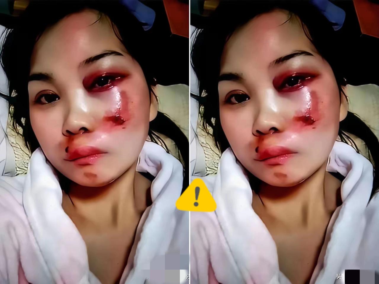 襄阳刘女士被家暴获200万播放却遭骂“活该”？这事儿真不是网友冷血，是她亲手