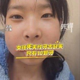 最近上海有个00后姑娘火了，不是因为颜值或才艺，而是因为她天生只有10颗牙——全