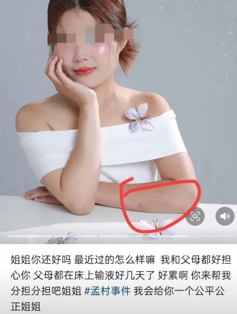 孟村25岁去世女子弟弟在网络平台发布怀念姐姐的图片，令人惊讶的是，这张图片女子打