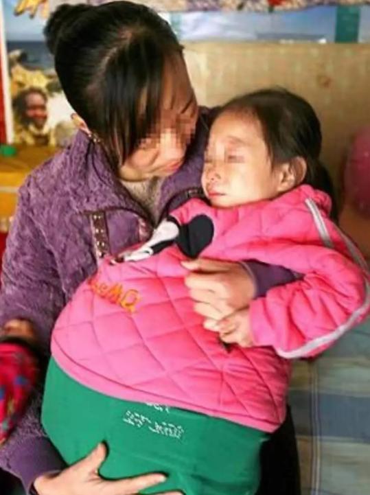 山西有个4岁的小姑娘，肚子肿得老大，鼓鼓囊囊的，大得像快要生产的孕妇。好几家医院