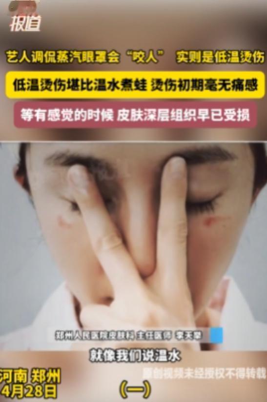 4月27日，当红演员杨幂在社交平台晒出被蒸汽眼罩烫伤的眼部照片，配文“蒸汽眼罩咬
