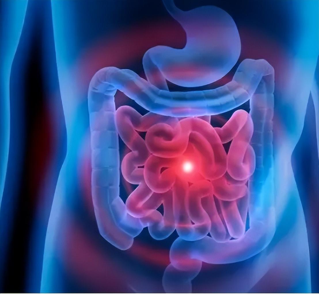 直肠癌看大便就知？提醒：上厕所时发现6个怪象，尽早做下肠镜大便的状态其实是肠