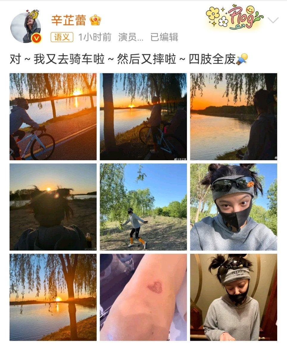 辛芷蕾腿摔出爱心辛芷蕾晒爱心伤疤辛芷蕾晒腿上爱心伤疤