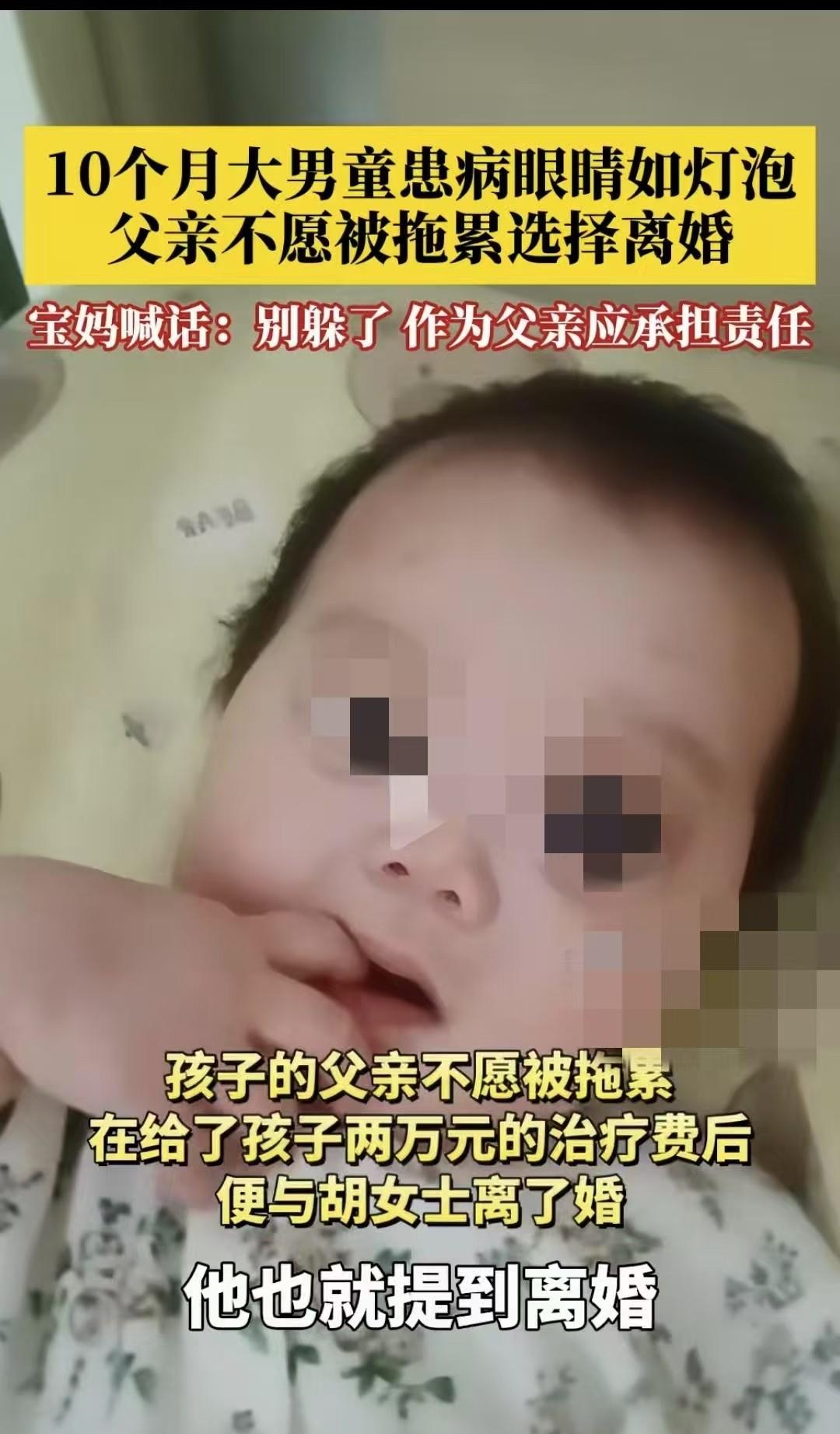 四川巴中，10月大的婴儿患病后眼大如灯泡，孩子父亲留下2万元以后，选择了离开。孩