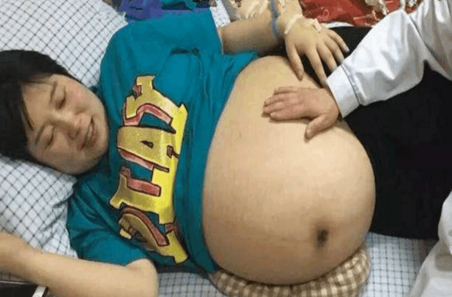 孕七月四胞胎提前发动, 看到宝宝的性别后, 整个妇产科都沸腾了