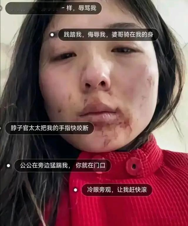 河南：女子被婆家5口人殴打，老公袖手旁观女子：正月初五的时候，被老公的姐姐和