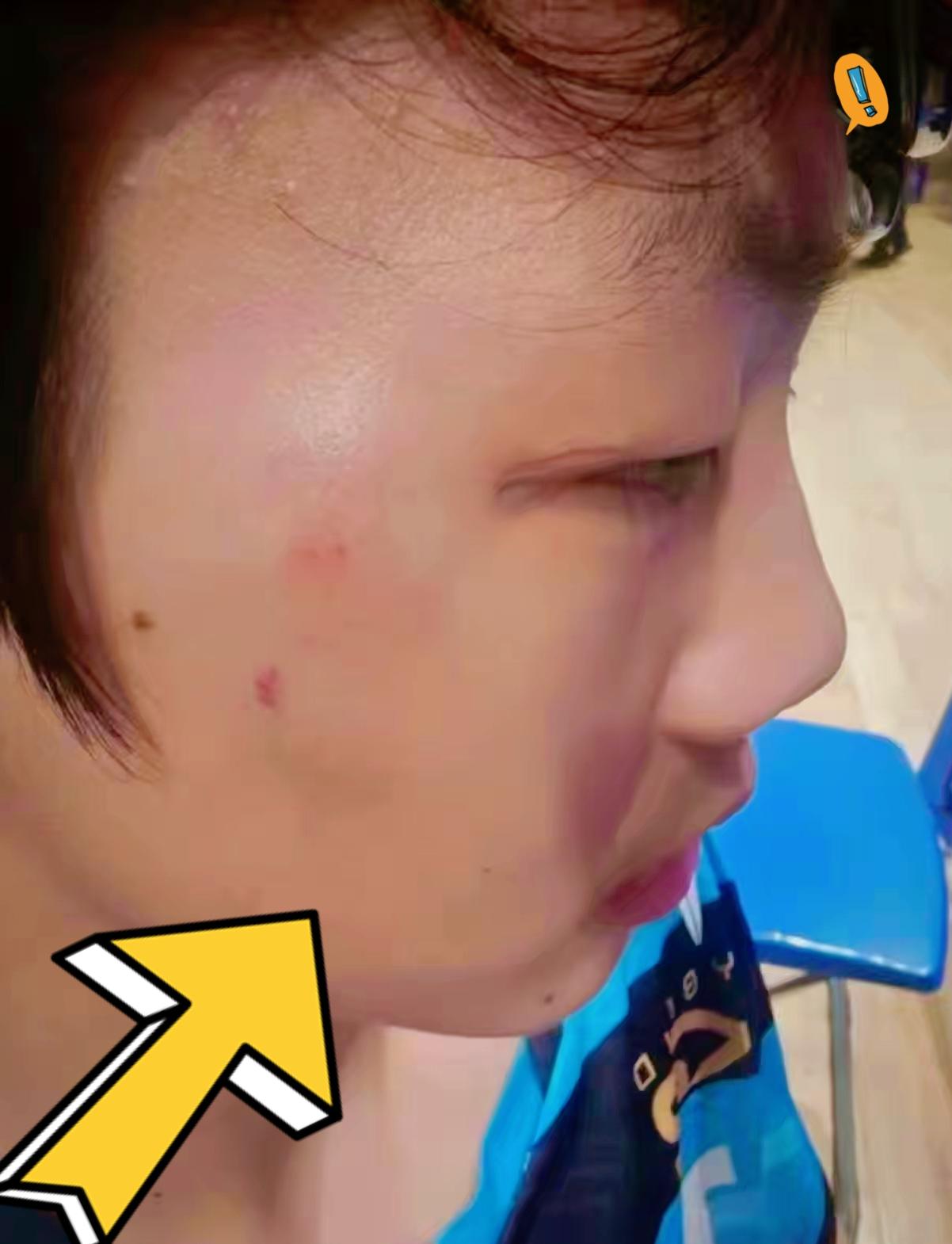 被曹彦灏打的小男孩，下手真的重。这男孩子和曹彦灏本身是认识的，也一起打球，江苏