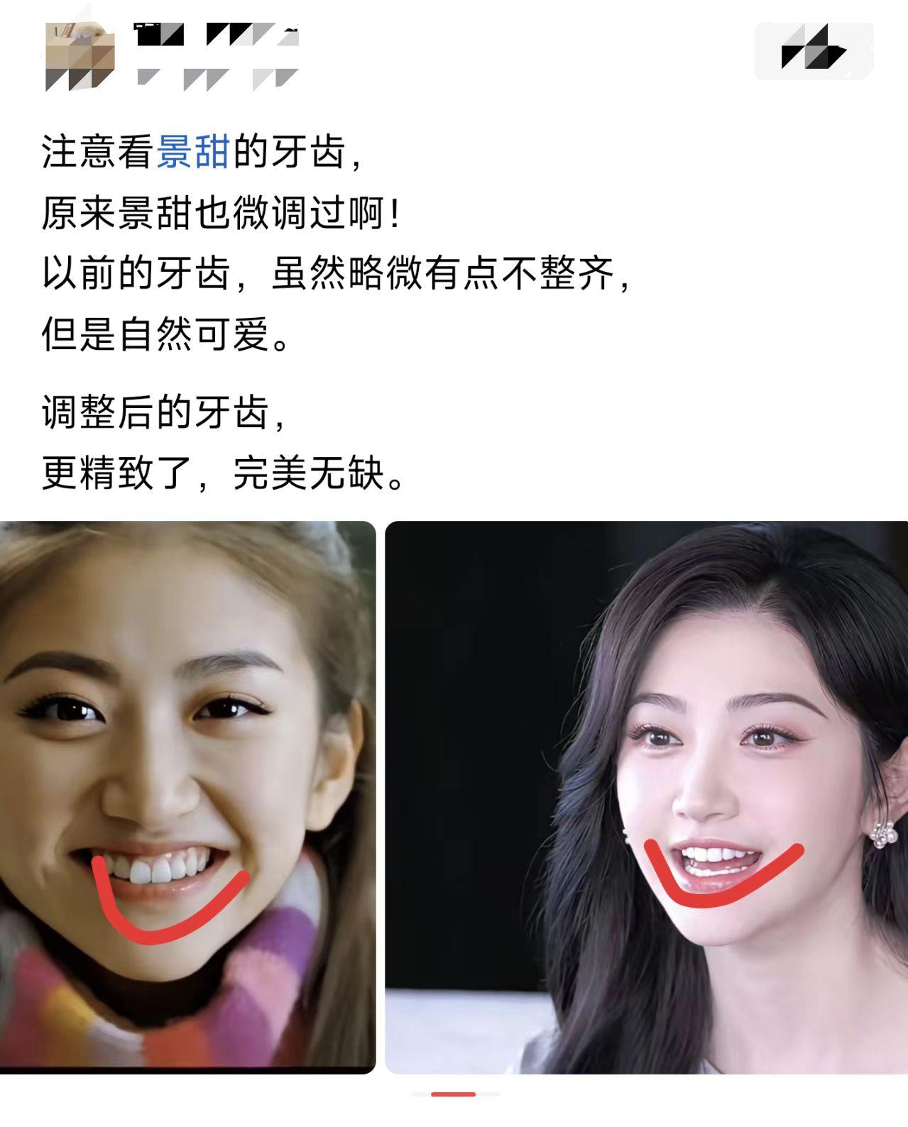 明星为了美，真舍得折腾