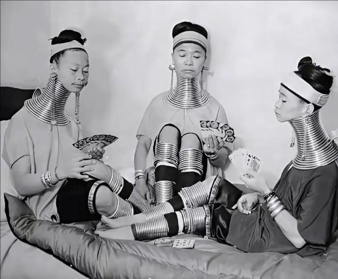1935年，三个缅甸长颈族妇女应邀到伦敦时的留影。只是她们没有想到对方并不是真诚