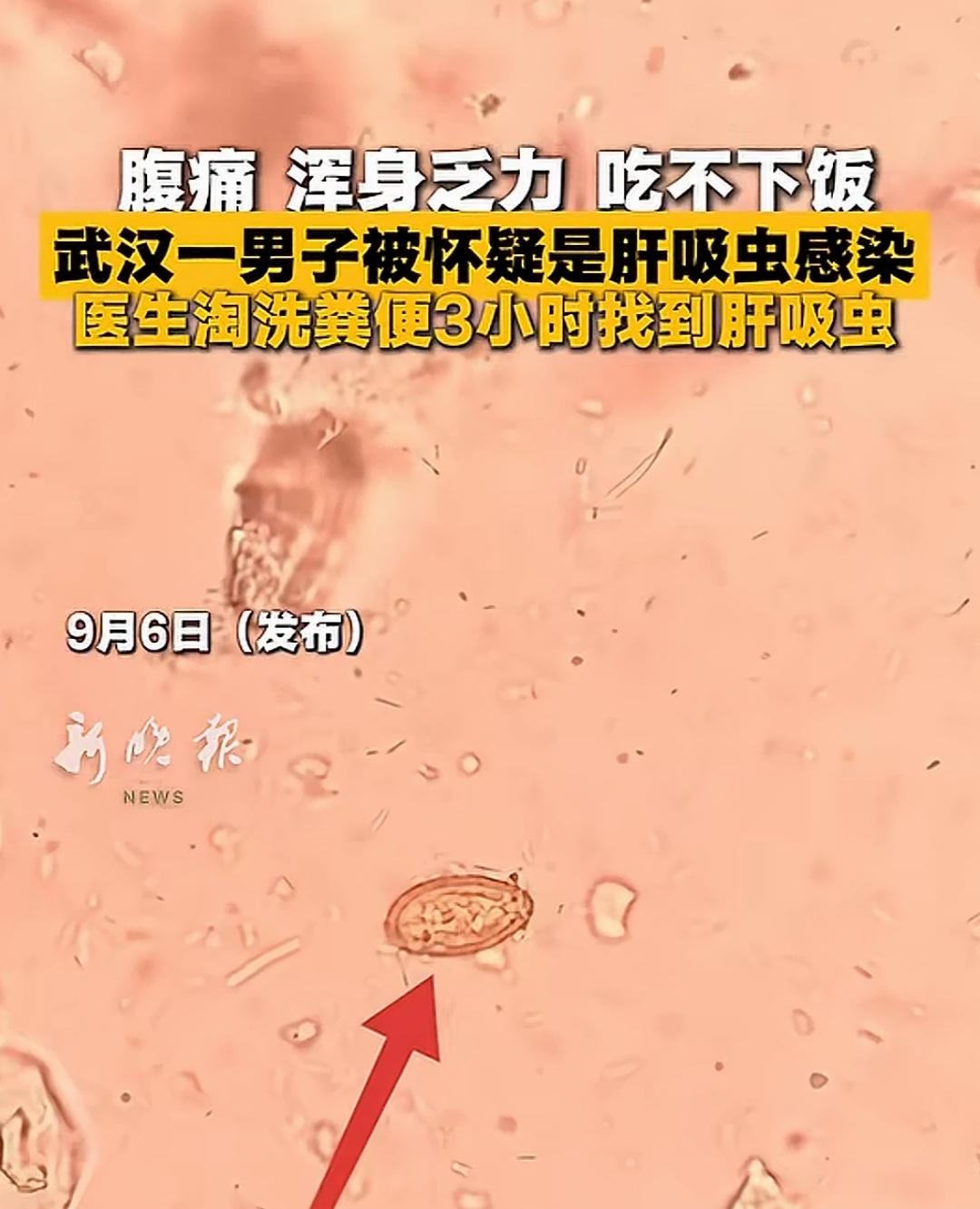 武汉，刘先生被不明低烧折磨了整整一个月，他辗转多家医院检查，却迟迟找不到病因，他