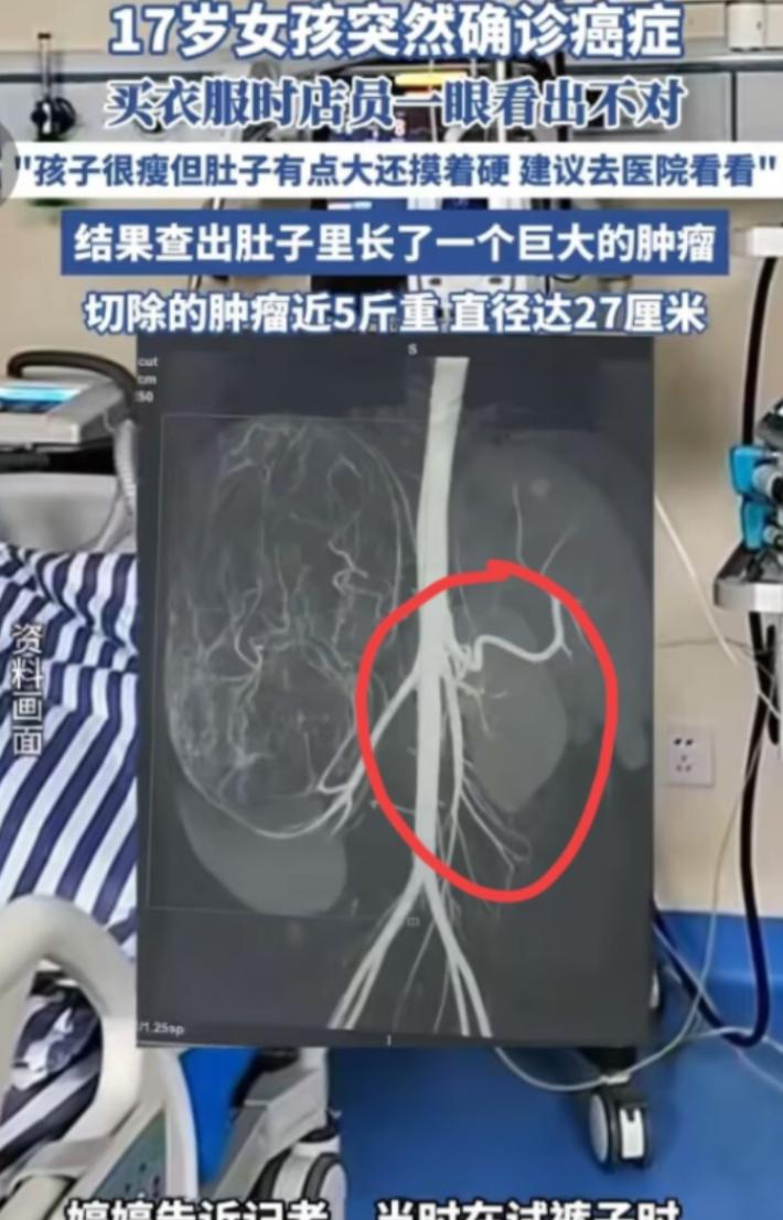 2025年6月，广东一个17岁的小姑娘和亲妈逛街买衣服，谁能想到，这竟成了她的“