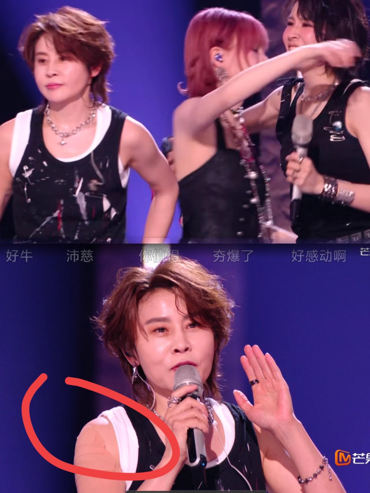 别再乱猜王濛胳膊上的贴片了，根本不是受伤，也不是养生膏药！而是因为她的胳膊上