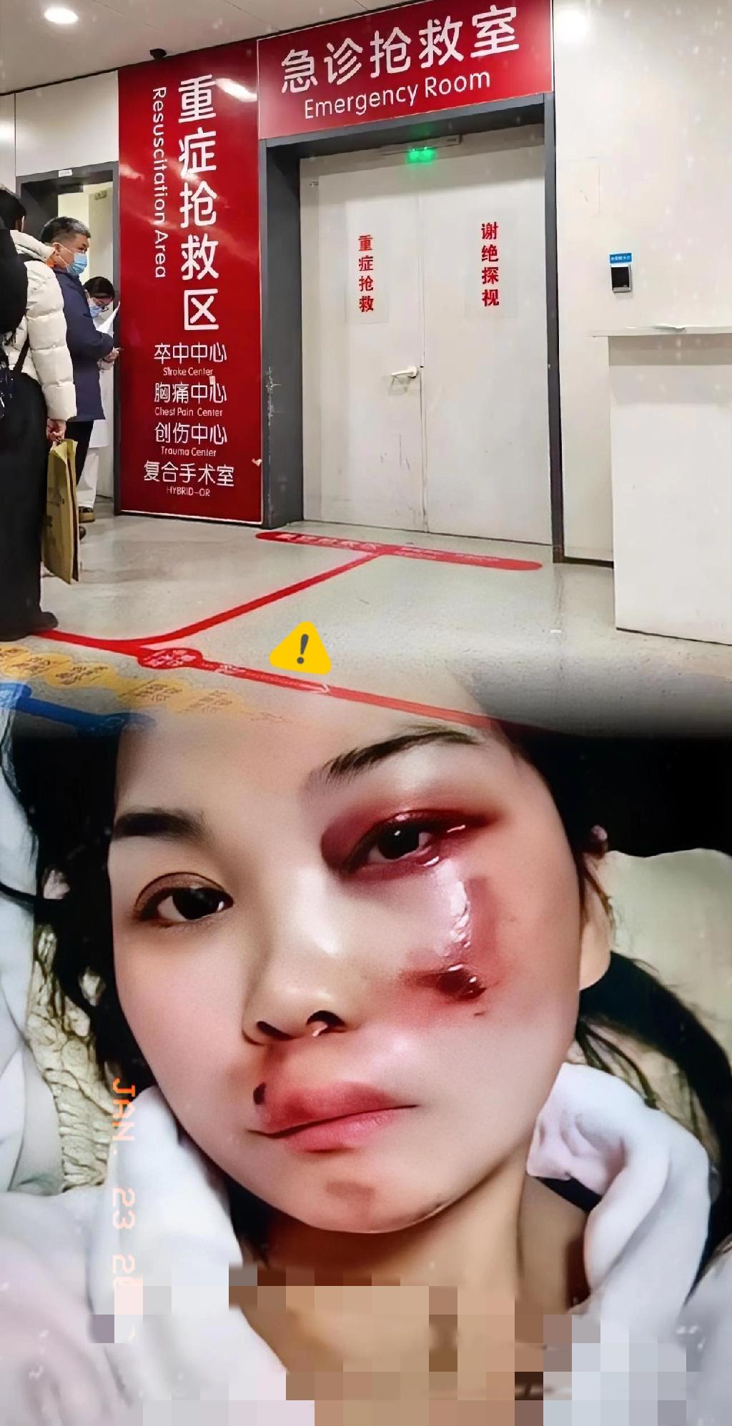 人心不足蛇吞象，但这回吞下去的是个炸弹。有个女的，嫌自家老公穷，没房没车，日子