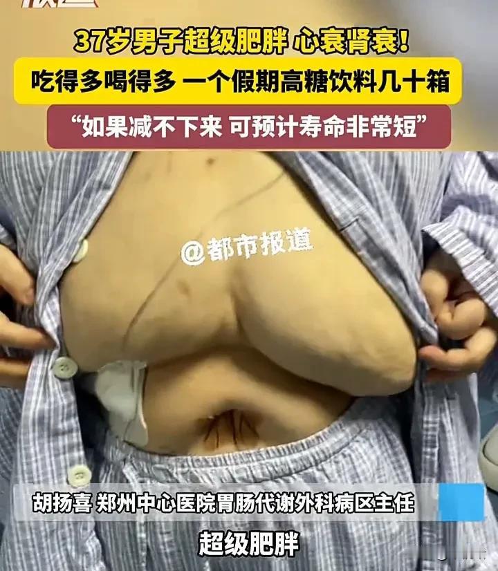 太悲哀了！近日，河南郑州一名37岁男子被医生提醒，如果体重减不下来，将会非常危险
