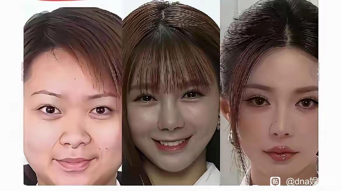 沈梦辰整容蜕变，真的算是改写人生了我翻到这张沈梦辰不同阶段的脸部对比图，冲击力真
