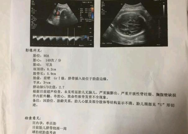 昨天顺产宝宝5斤6两是个男宝宝, 希望大家顺利不要侧切不要撕裂