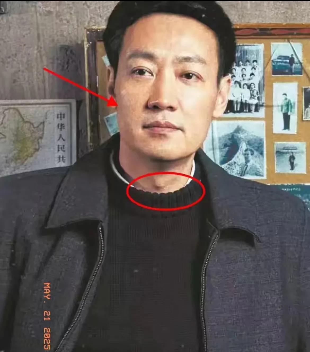 辛柏青状况令人担忧，据好友透露，他说不出话，证实了李乃文的担忧。自从5月21