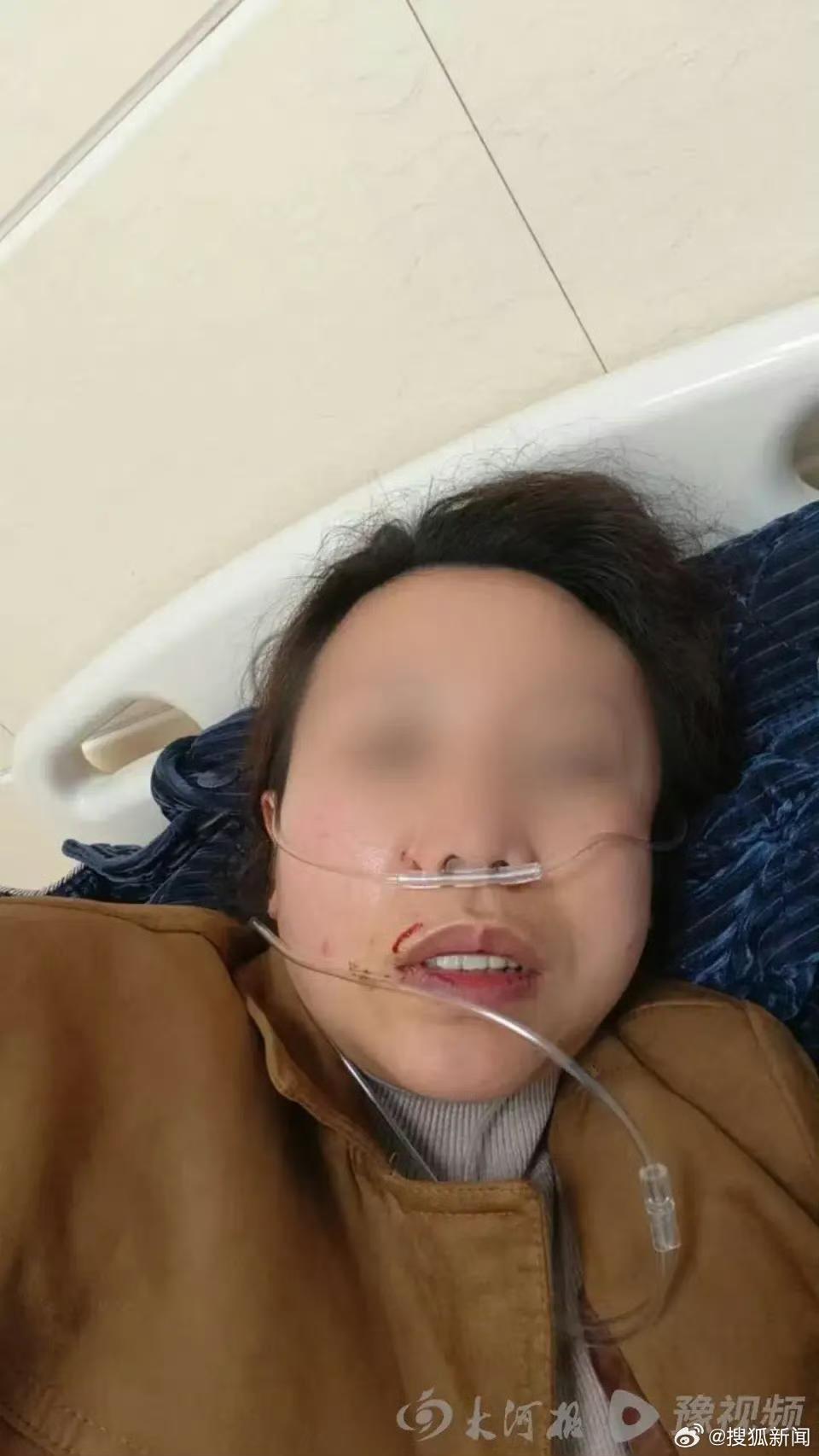 湖南新化一女子被前夫的现任老婆打断五根肋骨，只因为她质疑自己的孩子为什么要叫她妈