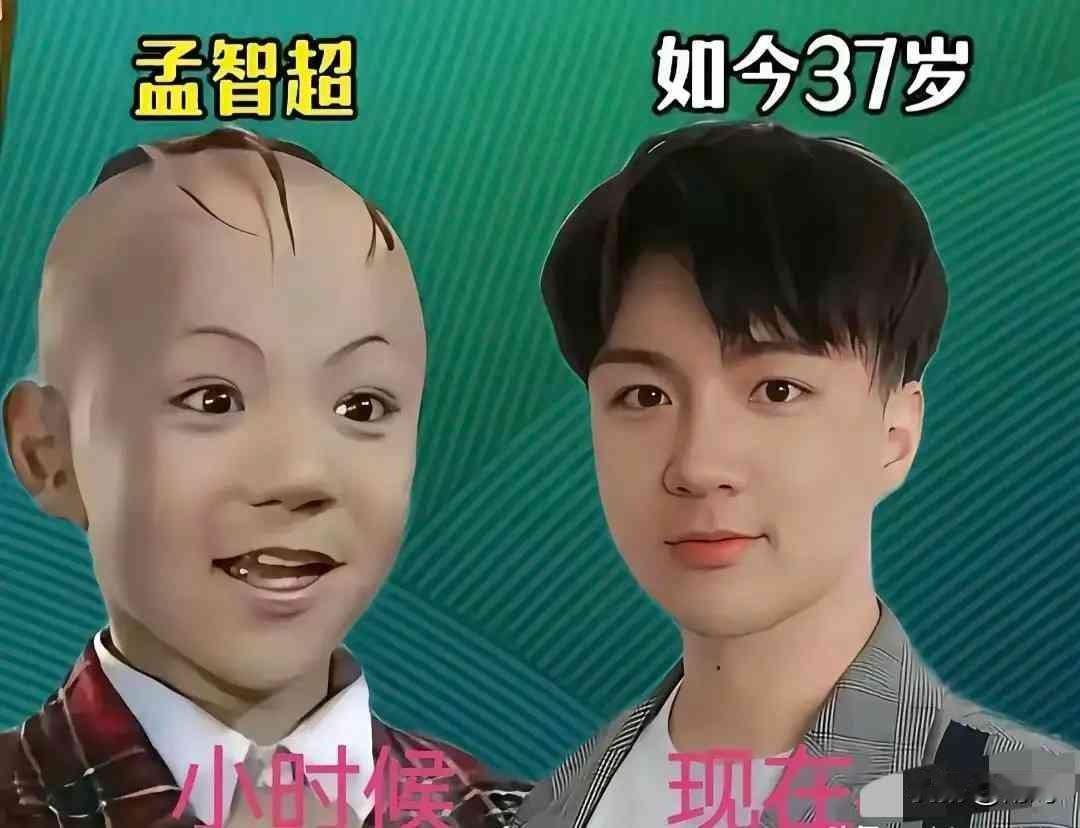 看着三毛那植发后彻底认不出的照片，我心里突然咯噔一下。这哪是什么“童星变形记”