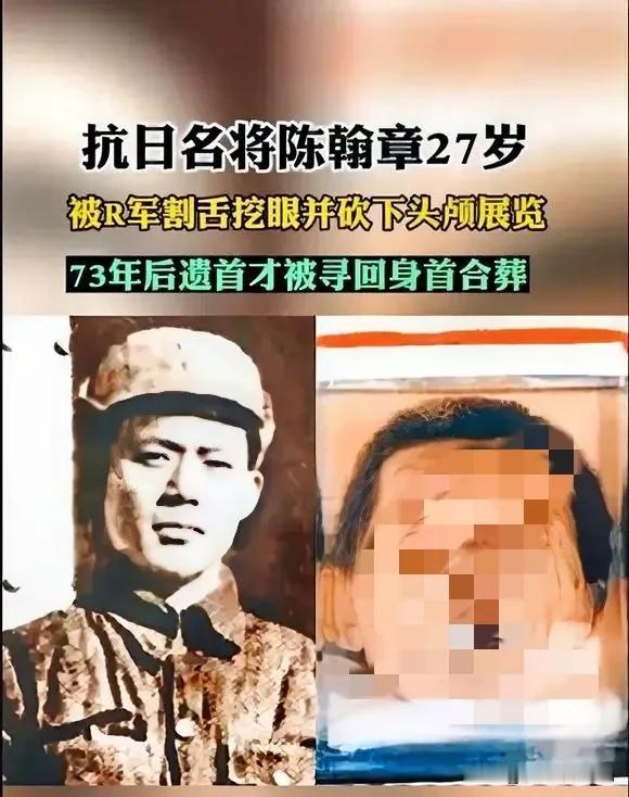 他27岁的头颅，在福尔马林里替我们看着今天