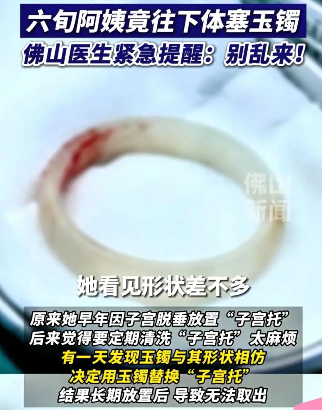 离谱，真是离谱到家了！广东65岁阿姨下身剧痛难忍，到医院一检查，连医生都惊出冷汗